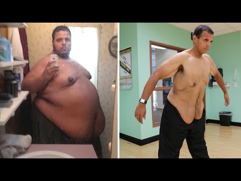 شاهد مدمن إنترنت يخسر 181 كيلو غرام من وزنه